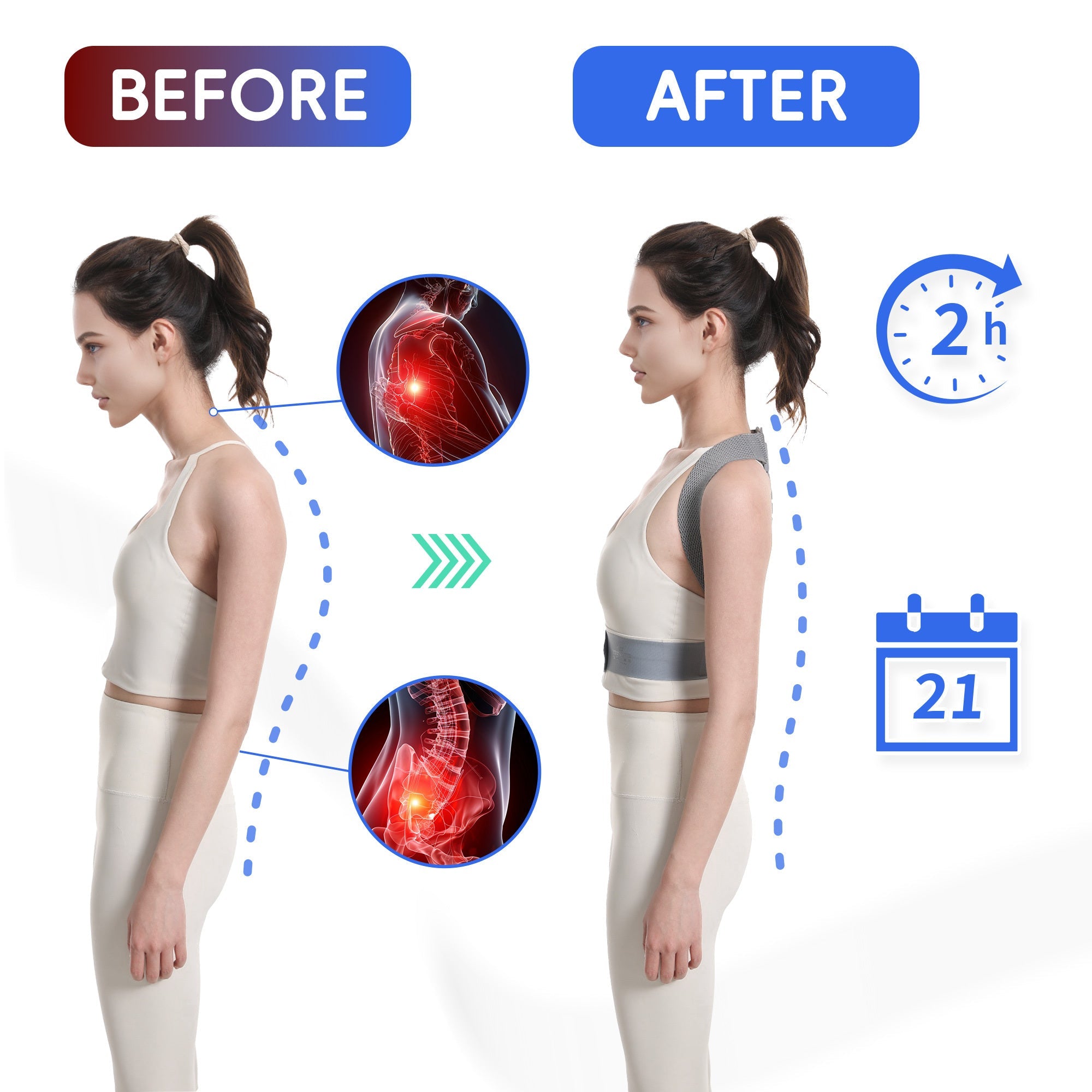 Back Support Posture Corrector For Women Men, Shoulder Supports & Immobilizers Scoliosis And Hunchback Adjustable Belt Back Brace For Lower Back Pain Posture Trainer PosturePro